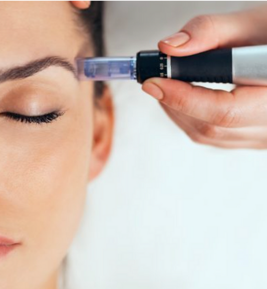 Facials | Microneedling (1 session)
